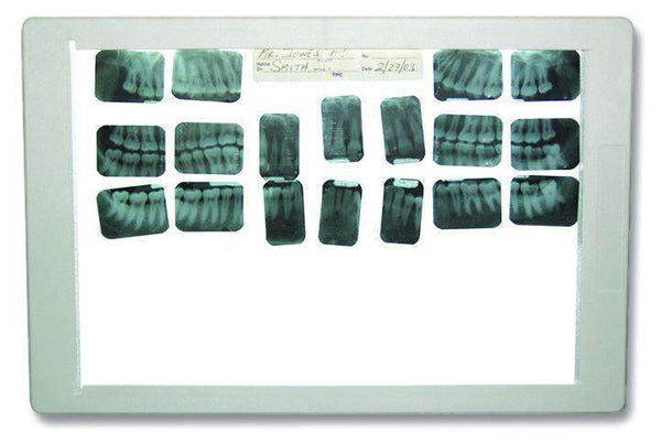 TPC Dental XV100 Super Thin X-ray Viewer